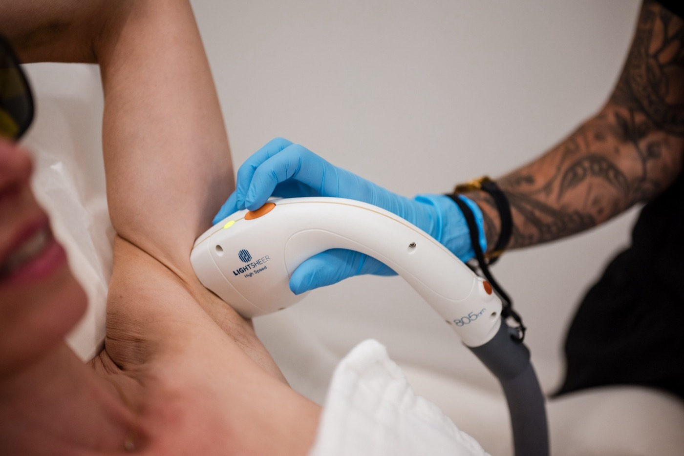 A smiling patient during underarm laser hair removal with the LightSheer